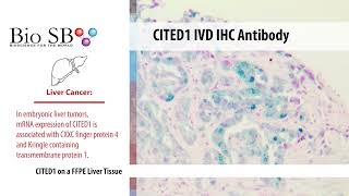 Bio SB - 2022 New CITED1 Antibody for IHC