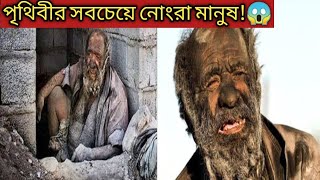 পৃথিবীর সবচেয়ে নোংরা মানুষ।The dirtiest people in the world।Mayajal।#shorts