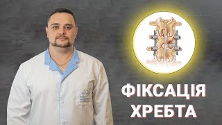 Транспедикулярна фіксація хребта. Травма хребта. Нестабільність хребта. Сколіоз