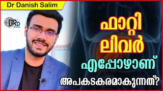 ഫാറ്റി ലിവർ എപ്പോഴാണ് അപകടകരമാകുന്നത്? Danger signals of Fatty Liver  Cirrhosis Prevention