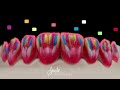 porcelain veneers multi layering with emax press and cream technique