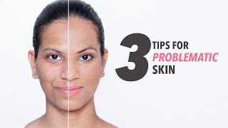 3 Skin Care & Makeup Tips For Acne Prone & Problematic Skin | Beauty Tips with Pallavi Symons