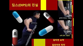 #딥스 의 진실.....#정형외과전문의 가 설명하는 부상없이 효율적으로  #딥스 하는 방법 입니다