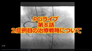 【心カテ】PCIライブ　第８話　第２症例の治療戦略について。ステントは置く？置かない？