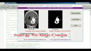 Brain Tumor Classification Using Machine Learning Brain Tumor Segmentation Using Matlab Source Code