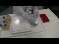 kirkhouse trust hpage gel sample preparation