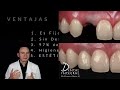 puentes vs implantes ¿cuál es la mejor opción dentista en querétaro