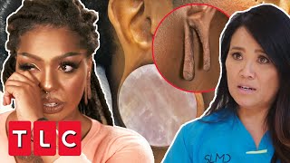 Dr Lee Restores Patient’s Overly Stretched Earlobe | Dr Pimple Popper: Pop Ups