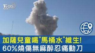 加薩兒童喝「馬桶水」維生! 60%燒傷無麻醉忍痛動刀｜TVBS新聞 @internationalNewsplus