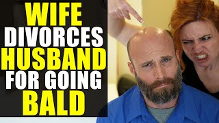 Wife DIVORCES Husband for GOING BALD