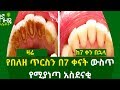 Ethiopia:- የበለዘ ጥርስን በ7 ቀናት ውስጥ የሚያነጣ አስደናቂ ውህድ | Nuro Bezede Girls