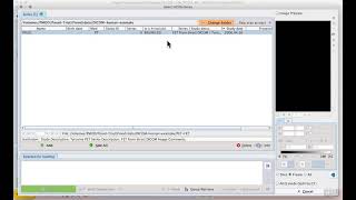 H1E2 Loading DICOM images