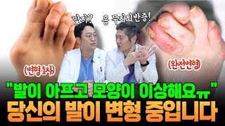 내 발가락이 아프고 이상하게 생겼으면 '무지외반증'