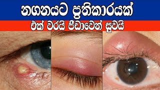 නගන වලට අත් බෙහෙතක් | Nagana walata | නගනයට සාර්ථක බෙහෙතක් | ඇසේ නගන වලට අත්දුටු ඔසුවක්