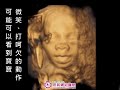 宏其婦幼醫院_4d立體彩色超音波_寶寶打呵欠