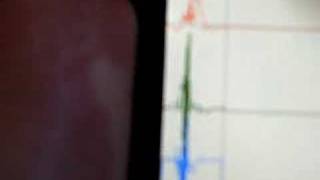 Accelerometer Log for iPhone & iPod Touch