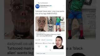 Black Alien Project Leg Amputation Makes Headlines