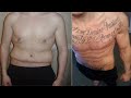 how to get rid of loose belly skin after weight loss tutorial