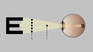 Visual Acuity Assessment: Optotype Construction