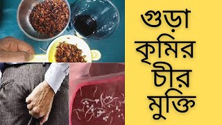 গুড়া কৃমি হতে চীর মুক্তি মিলবে চাউল ভাজা পানি পান করলে।