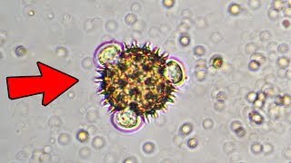 10 Crazy Things Seen Under Microscope
