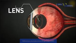 Dr. Florence Breaks Down How Your Eyes Actually Works