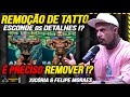 A FEBRE DA REMOÇÃO DE TATUAGEM NO BODYBUILDING !!!