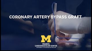 Cardiac Surgery Simplified: Coronary Artery Bypass Graft