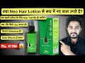 Neo Hair Lotion for Hair Fall: Usage, Benefits, Side Effects, Result l Detailed Review