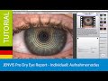 JENVIS Pro Dry Eye Report - Individuell: Beurteilungsmodus