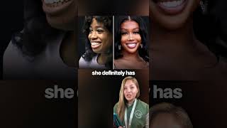 SZA’s plastic surgery 💅🏼 #sza #plasticsurgery #celebrity