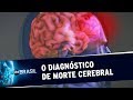 Neurocirurgião explica rígido protocolo para diagnóstico de morte cerebral | SBT Brasil (23/11/19)