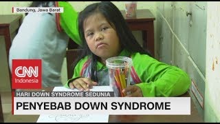 Penyebab Down Syndrome | Hari Down Syndrome Sedunia