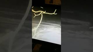 santa claus caught on camera