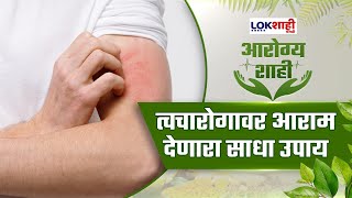 Arogyashahi: त्वचारोगावर आराम देणारा साधा उपाय | Lokshahi Friendly