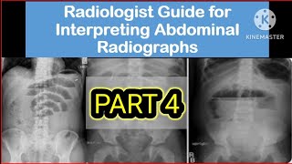 Radiologist guide for interpreting Abdominal radiographs PART 4