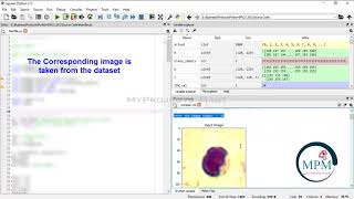 PYTHON 2021 Project - Types Of Blood Cell Classification Using Local Binary Pattern - Image Process