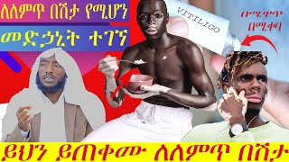 🔴ለለምጥ በሽታ የሚሆን መድኃኒት ተገኘ||ይህን ይጠቀሙ ለለምጥ በሽታ||Vitiligo||Ethiopia