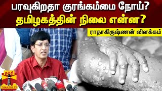 பரவுகிறதா குரங்கம்மை நோய்?  தமிழகத்தின் நிலை என்ன? - ராதாகிருஷ்ணன் விளக்கம்