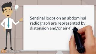 What are sentinel loops?