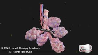 Asthma Explained - Best Video