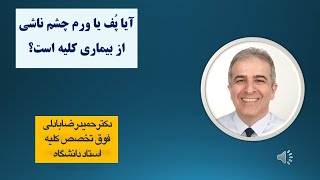 آیا همیشه ورم یا پُف چشم بدلیل نارسایی کلیه ها است؟