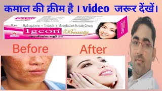 Igcon beauty cream | igcon beauty cream kaise use kare |  igcon cream #drxrabbani #hindi