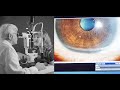 Before Cataract Surgery - What I Wish I Knew (1/4) (4K)