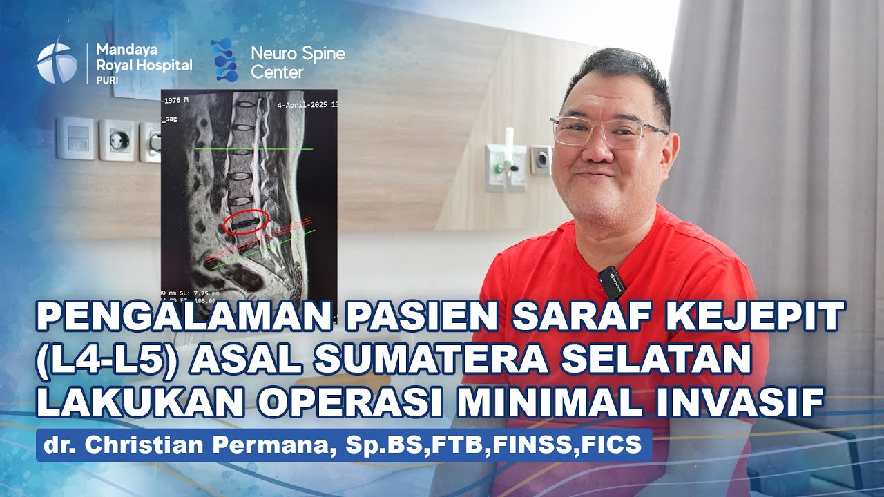Pengalaman Pasien Saraf Kejepit L4 L5 Lakukan Operasi Minimal Invasif