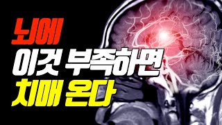 뇌에 '이것' 부족하면 기억력 급격히 떨어진다. 치매 예방에 좋은 음식