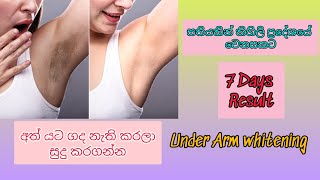 කිහිලි ප්‍රදේශය පැහැපත් කරගමු|Under Arm Whitening|අත් යට දහඩිය දුගඳ නැති කරමු