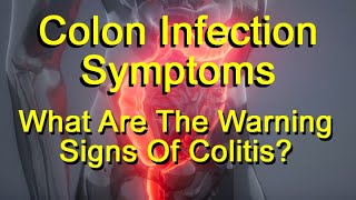 Colon Infection Symptoms - What Are The Warning Signs Of Colitis?