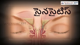 What Is Sinusitis ? || Sinus Infection || Symptoms and Treatment || Dr.Vinnakota Sriprakash advises