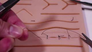 Simple Interrupted Suture Technique